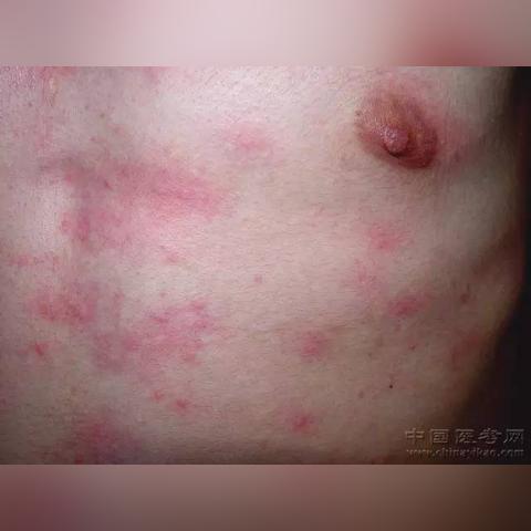 全世界最贵番薯排名，最贵的红薯品种是什么品种